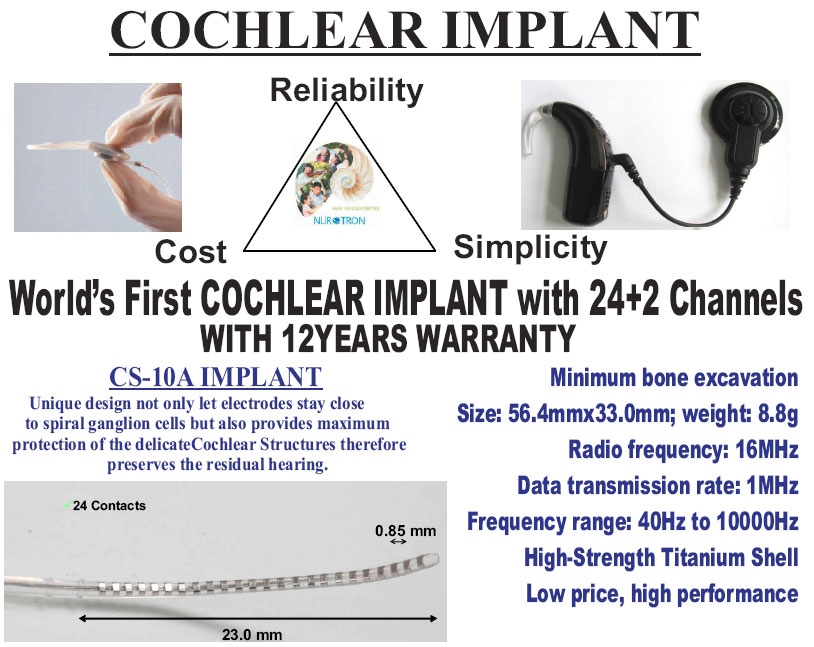 cochlearimplant